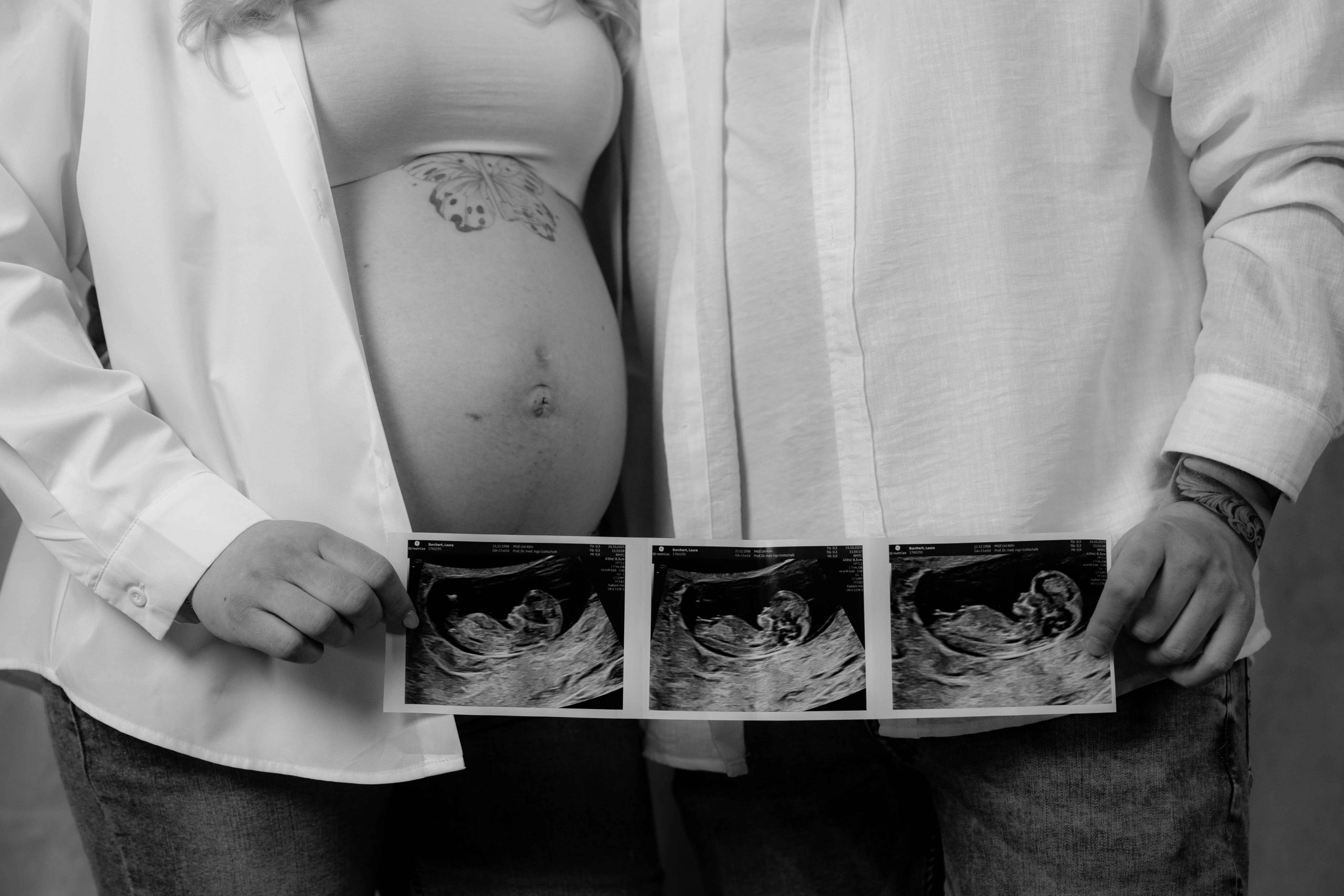 babybauch-anna-oliver-4